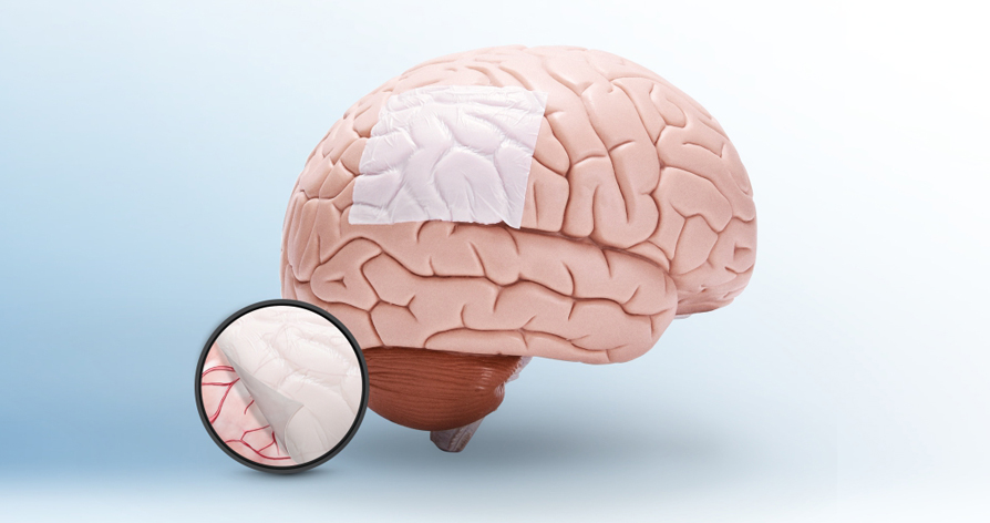 ?？?硬腦(脊)膜補(bǔ)片