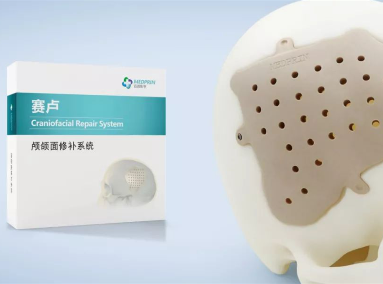 前額出現大坑怎么辦？賽盧修補后恢復原貌