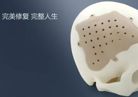 精準定制，完美修復——從“頭”開始