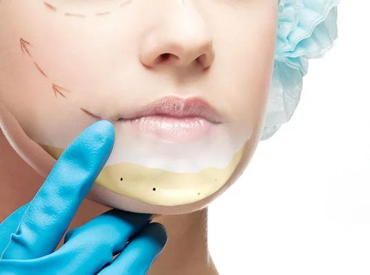 醫(yī)用材料“網紅”，也進軍整形美容界了！